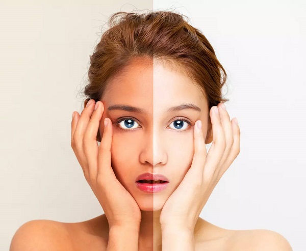 آفتاب سوختگی